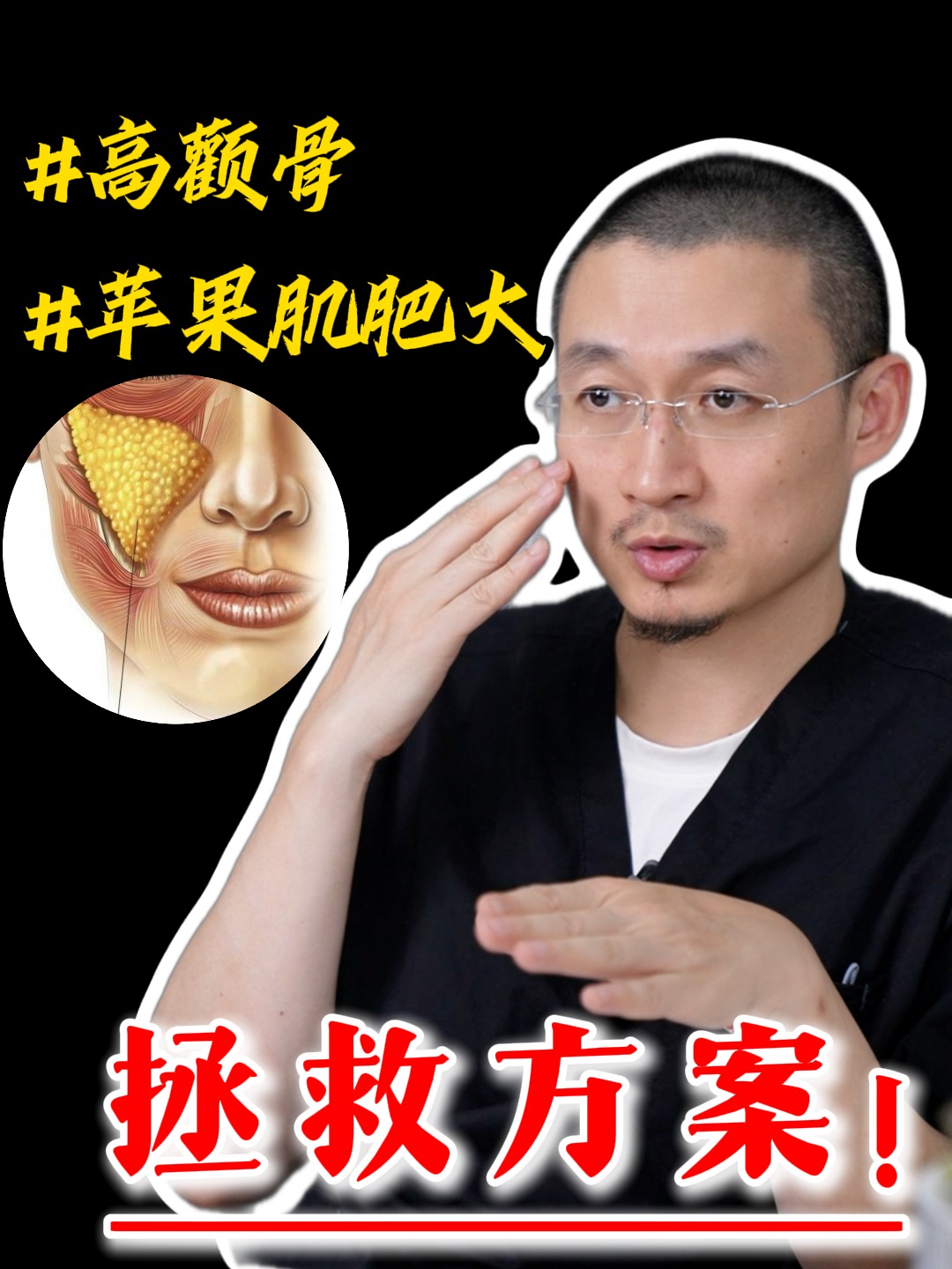 苹果肌肉版(苹果肌肉多怎么瘦下去)